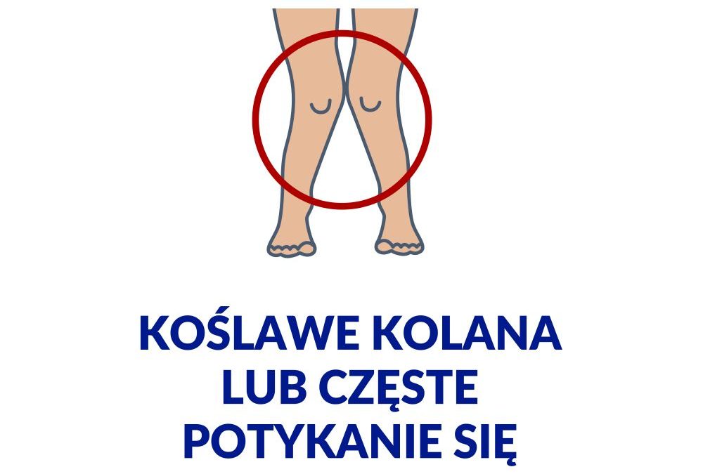 Wady postawy koślawość kolan