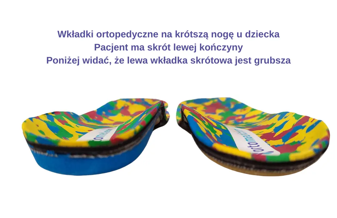 Krótsza noga u dziecka, wkładki ortopedyczne skrótowe wykonane  przez fizjoterapeutę Ortomedicum.