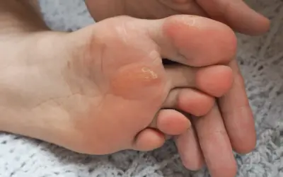 Problemy ze stopami. O jakich chorobach powiedzą Ci stopy?