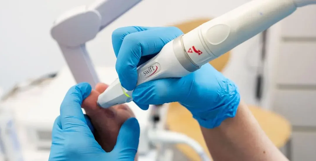 Brodawki wirusowe (kurzajki) – skąd się biorą i jak je skutecznie leczyć