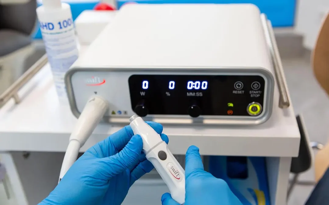 Terapia Swift – przełom w leczeniu brodawek wirusowych