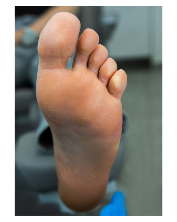 Metoda swift - po terapii